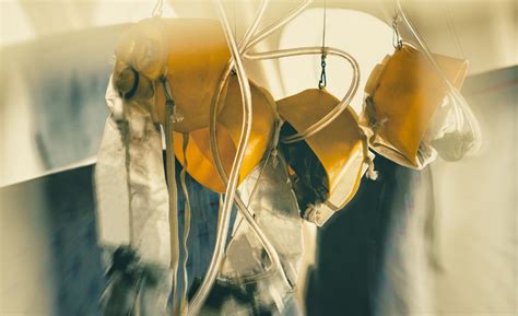 What are the different types of decompression aviation