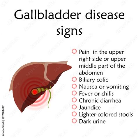 What are the symptoms of an inflamed gallbladder?