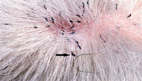 What are tiny black bugs on my dog? - letshealthify.com