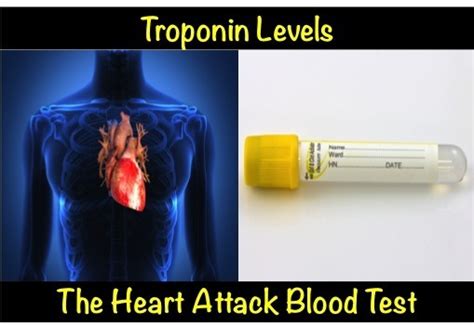 What blood work shows a heart attack? - Quora