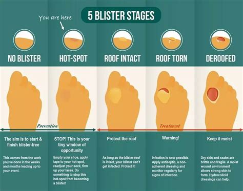 What can I do to prevent bubbles and blisters?