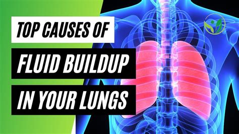 What causes buildup of fluid in the body? - coalitionbrewing.com