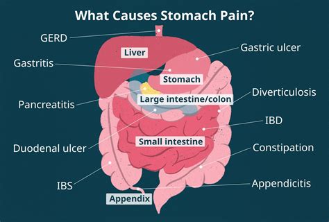 What causes pain in the upper part of the stomach?