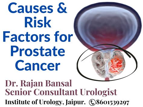 What causes prostate cancer? - WCRF International