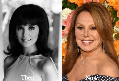 Did Marlo Thomas have plastic surgery to change her face? This article