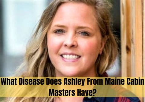 What disease does ashley from maine cabin masters have. ON TONIGHT’S EPISODE: A Cabin for Karly💕🌸🌺 Kristin's family has owned this cabin for five generations, but now would like to add on to the kitchen and raise the roof - quite literally - to … 