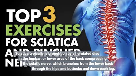 What doctor should i see for sciatica