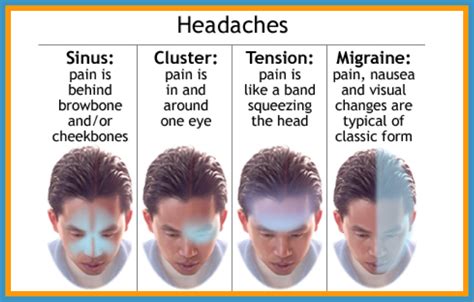 What does a brain bleed headache feel like?