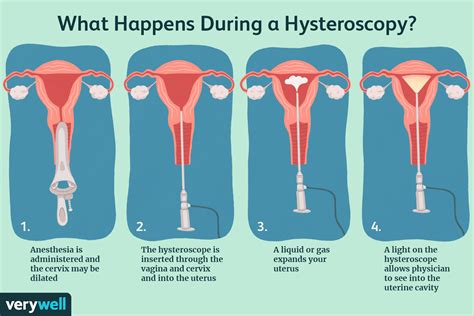 What does a hysteroscopy show