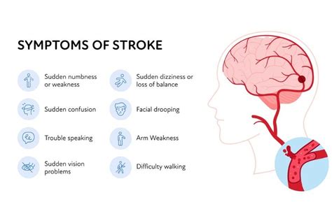 What does a mild stroke feel like