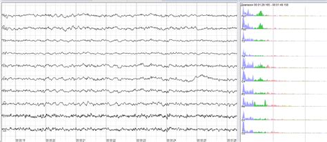 What does an eeg show