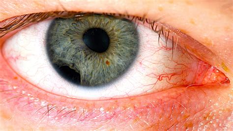 What does eye damage look like