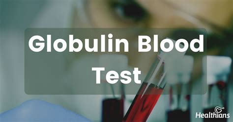 What does it mean when your alpha 1 globulin is low?