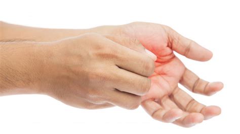 What does it mean when your left thumb itches. Things To Know About What does it mean when your left thumb itches. 
