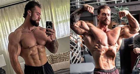 What happened to Chris Bumstead? What disease does the