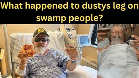 What happened to dusty's leg. Celebrity Family. 66.5K subscribers. Subscribed. 20. 2.6K views 1 year ago. Dusty Crum has scars all over his leg. He had met a huge accident in 2021 and was … 
