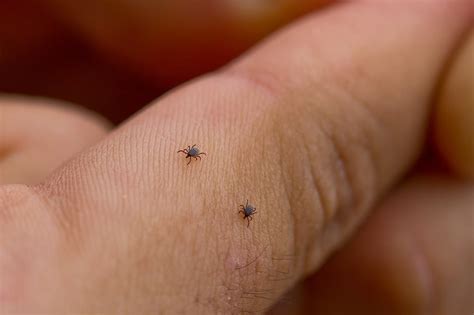 What happens when mites bite humans? - ibetha.dixiesewing.com