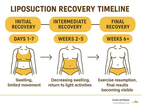 What happens years after liposuction.  Where to Turn for Answers The So...