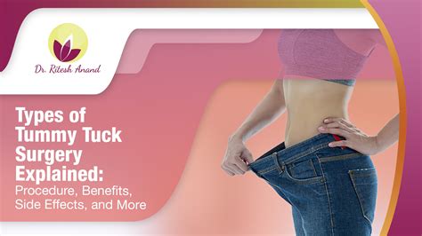 What is A Tummy Tuck? 5 Medical Benefits Of The Surgical …