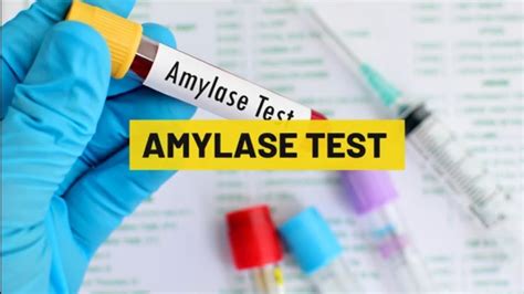 What is Amylase test _ Normal Range and Interpretation in Pancreatitis