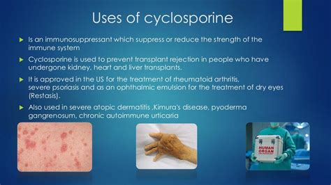 What is Cyclosporine: Uses, Warnings, Interactions & FAQs