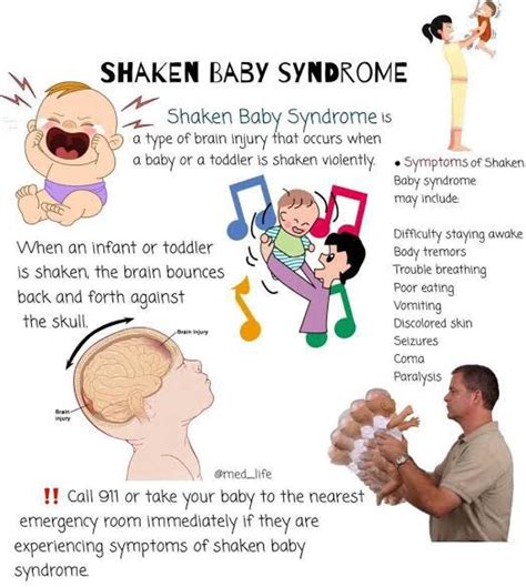 What is Shaken Baby Syndrome? - icliniq.com