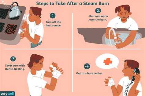 What is a Steam Burn? - Smart Academic Writing