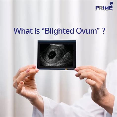 What is a blighted ovum? Causes, symptoms and treatment