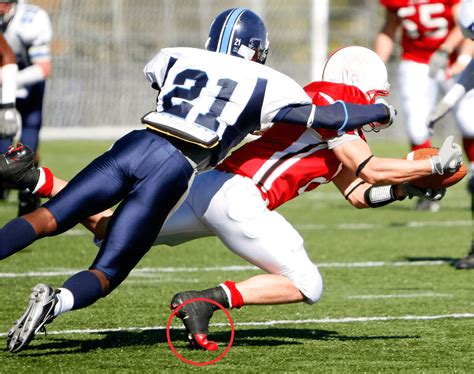 What is a turf toe injury in NFL 