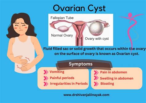 What is an involuting ovarian cyst? is it anything to worry …