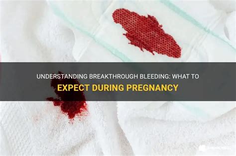 What is breakthrough bleeding. .  <a href=https://lookrussian.ru/hosl1el/desi-mum...