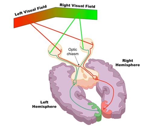 What is contralateral control in regards to the brain? - Quora