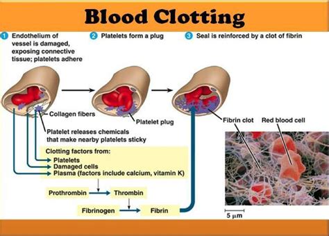 What is destruction of a blood clot in medical terms? - Answers