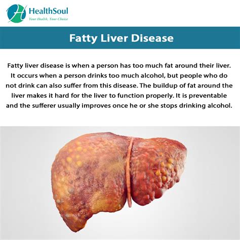 What is fatty liver disease and how is it treated?