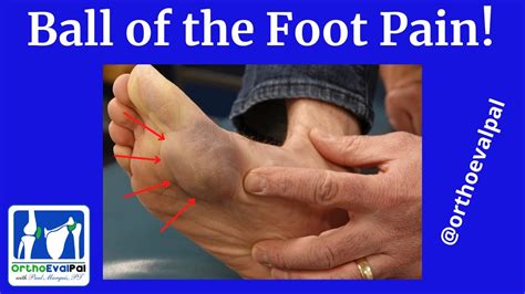 What is it when your feet hurt