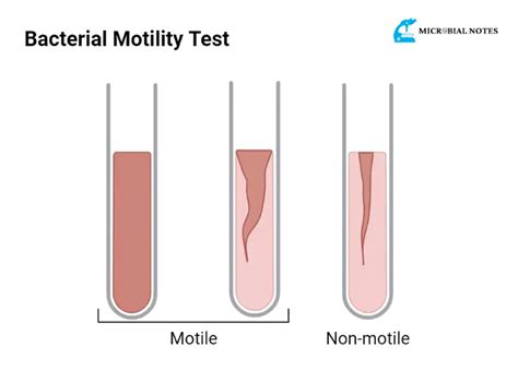 What is motility testing Its methods and applications