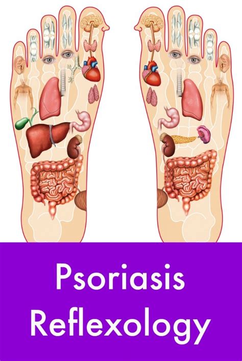 What is reflexology for psoriasis 