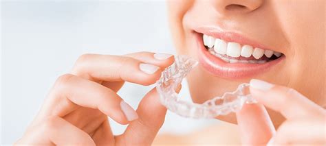 What is the Cost of Invisalign in Canada? - Art of Dentistry