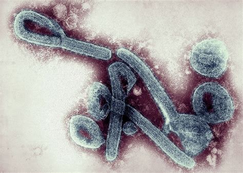 What is the Marburg virus? Another country reports outbreak of 'highly virulent' disease