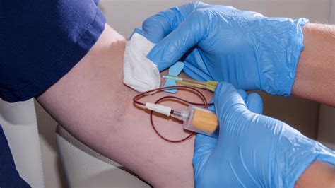 What is the Most Common Method for Drawing Venous Blood Syringe
