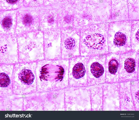 What is the chromosomes number of an onion root cell during anaphase …