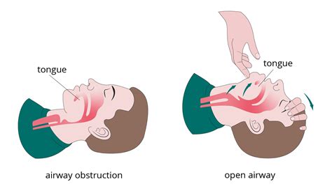 What is the correct procedure for clearing the airway?