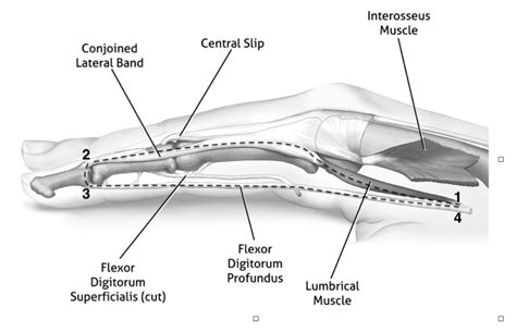 What is the lumbricals function? Hand Therapy Academy