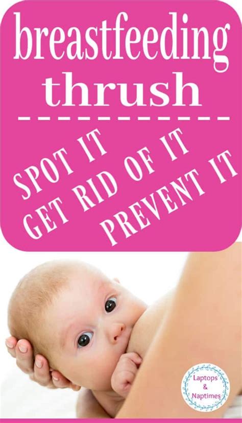What is thrush while breastfeeding