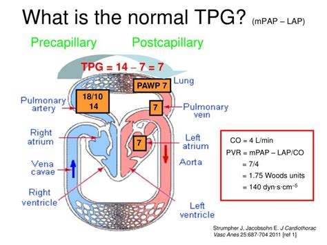 What is tpg. The TPG is the difference between mean P pa and left atrial pressure (P la). P la is usually estimated by P pcw. The TPG is thought to be particularly useful to diagnose “out of proportion pulmonary hypertension” in patients with left heart failure or mitral stenosis . 