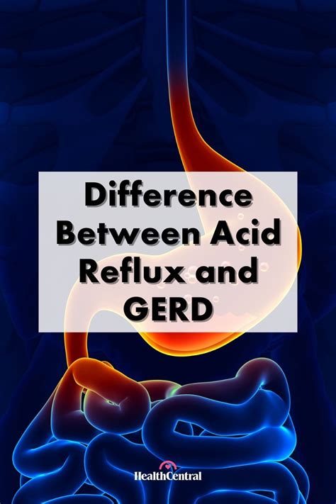 What s the Difference Between Acid Reflux and GERD Everyday Health