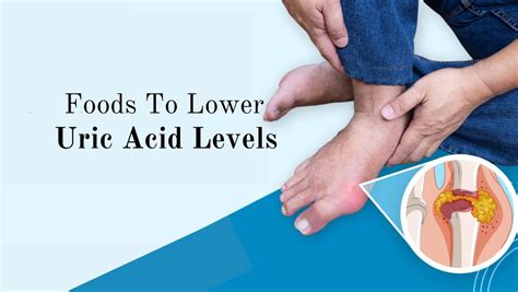 What should eat in uric acid