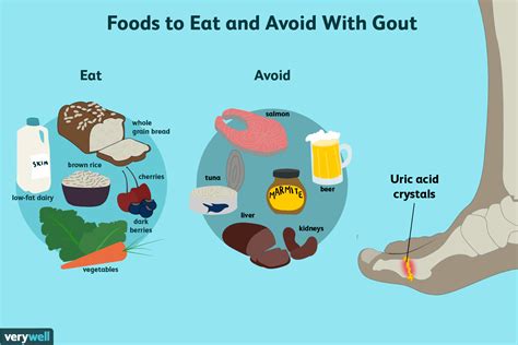 What should i not eat with gout