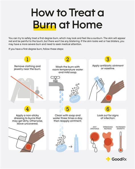 What should u put on a burn