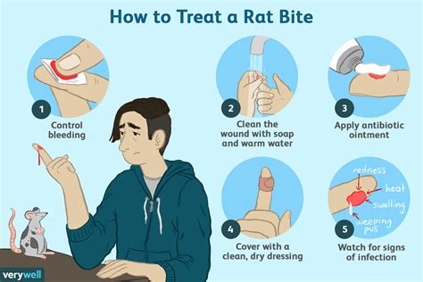 What should we do when rat bites